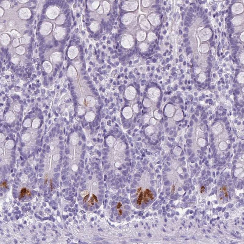 Anti-TMEM91 Antibody