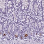 Anti-TMEM91 Antibody