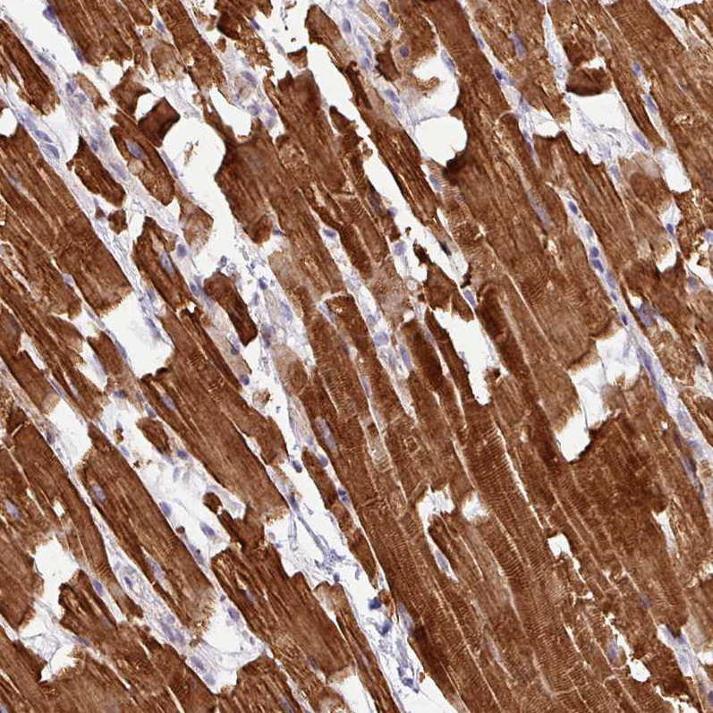 Anti-HBEGF Antibody