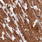 Anti-HBEGF Antibody