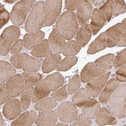 Immunohistochemical staining of human skeletal muscle shows moderate cytoplasmic positivity in myocytes.