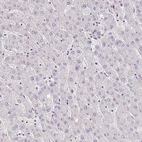 Immunohistochemical staining of human liver shows no positivity in hepatocytes as expected.