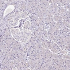 Immunohistochemical staining of human pancreas shows no positivity in exocrine glandular cells as expected.