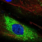 Anti-PTPRQ Antibody