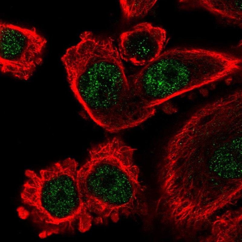Anti-IFI44L Antibody