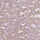 Anti-RGS16 Antibody