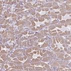 Anti-RGS16 Antibody
