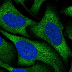 Immunofluorescent staining of human cell line U-2 OS shows localization to cytosol.
