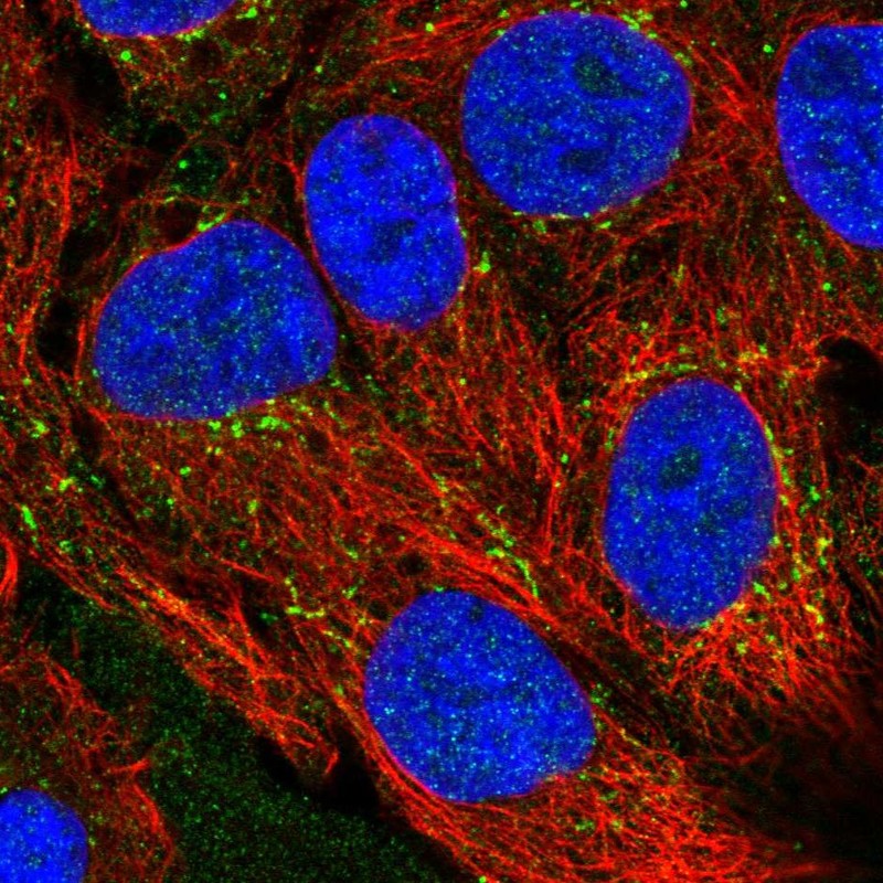 Anti-CXCL16 Antibody