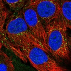 Anti-CXCL16 Antibody