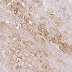 Immunohistochemical staining of human placenta shows moderate membranous positivity in extravillous trophoblastic cells.