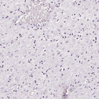 Immunohistochemical staining of human placenta shows no positivity in decidual cells as expected.