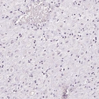 Immunohistochemical staining of human placenta shows no positivity in decidual cells as expected.