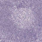 Immunohistochemical staining of human tonsil shows no positivity in lymphoid cells as expected.