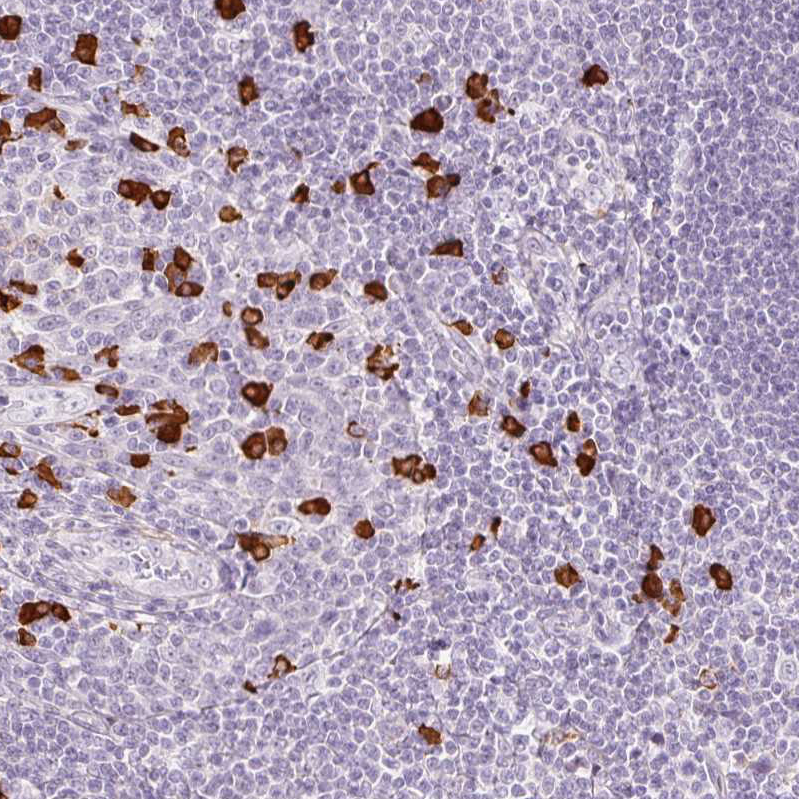 Anti-PRPF38B Antibody