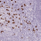 Anti-PRPF38B Antibody