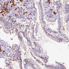 Immunohistochemical staining of human duodenum shows strong cytoplasmic positivity in lymphoid cells.