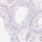 Immunohistochemical staining of human testis shows negative cytoplasmic positivity in cells in seminiferous ducts as expected.