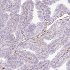Immunohistochemical staining of human fallopian tube shows negative cytoplasmic positivity in glandular cells as expected.