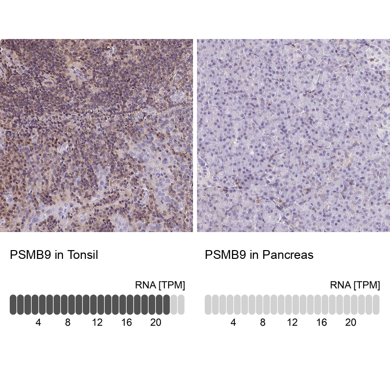 Anti-PSMB9 Antibody