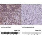 Anti-PSMB9 Antibody