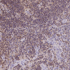 Anti-PSMB9 Antibody