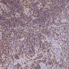 Immunohistochemical staining of human tonsil tissue shows moderate cytoplasmic/nucleus positivity in non-germinal center cells.