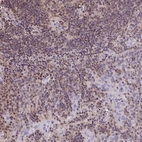 Immunohistochemical staining of human tonsil tissue shows moderate cytoplasmic/nucleus positivity in non-germinal center cells.