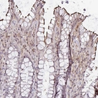 Immunohistochemical staining of human rectum shows moderate membranous/cytoplasmic positivity in glandular cells and weak cytoplasmic positivity in lymphoid cells.