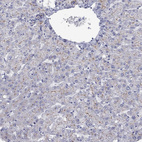 Anti-ABCB4 Antibody