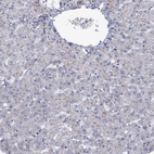 Anti-ABCB4 Antibody