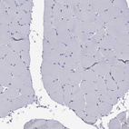 Immunohistochemical staining of human skeletal muscle shows no positivity in myocytes as exected.