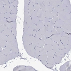 Immunohistochemical staining of human skeletal muscle shows no positivity in myocytes as exected.