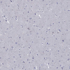 Immunohistochemical staining of human cerebral cortex shows no positivity in neurons as expected.