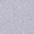 Immunohistochemical staining of human cerebral cortex shows no positivity in neurons as expected.