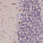 Immunohistochemical staining of human cerebellum shows moderate cytoplasmic positivity in Purkinje cells.