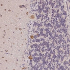 Immunohistochemical staining of human cerebellum shows moderate cytoplasmic positivity in Purkinje cells.