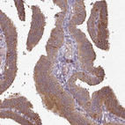 Immunohistochemical staining of human fallopian tube shows moderate cytoplasmic positivity in glandular cells.