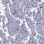 Immunohistochemical staining of human placenta shows no positivity in trophoblastic cells as expected.