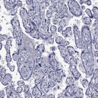 Immunohistochemical staining of human placenta shows no positivity in trophoblastic cells as expected.