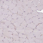 Immunohistochemical staining of human skeletal muscle shows no cytoplasmic positivity in myocytes as expected.