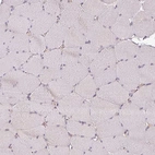 Immunohistochemical staining of human skeletal muscle shows no cytoplasmic positivity in myocytes as expected.