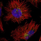 Immunofluorescent staining of human cell line U-251 MG shows positivity in vesicles.