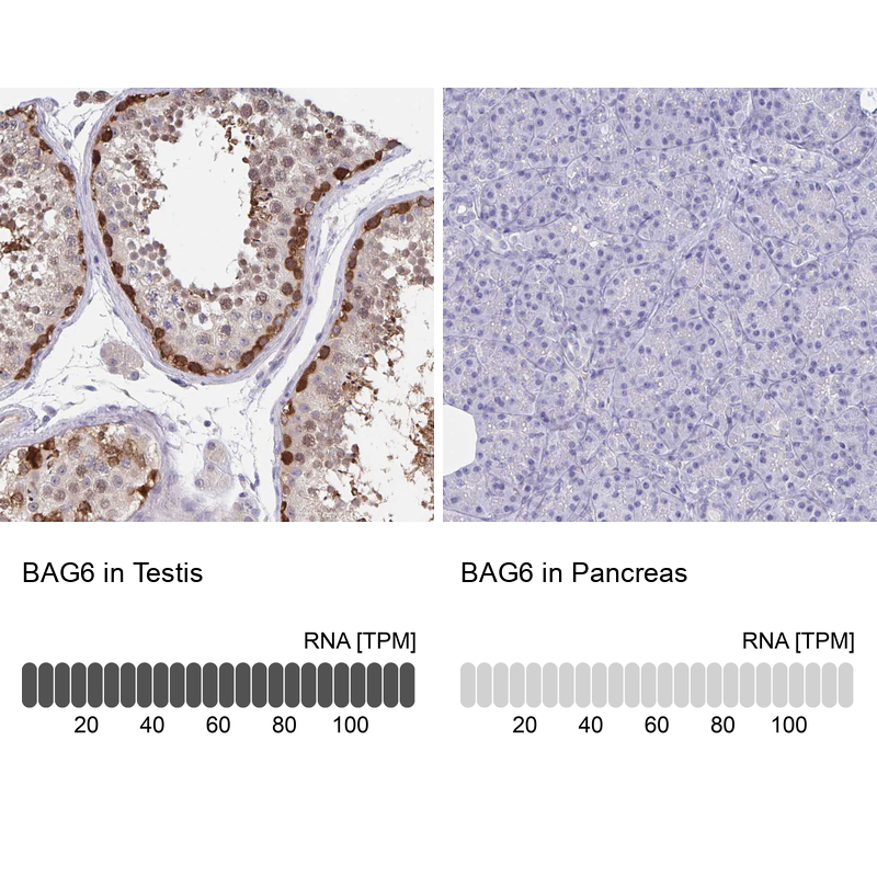 Anti-BAG6 Antibody