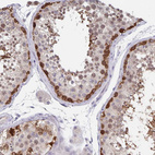 Immunohistochemical staining of human testis shows strong nuclear and cytoplasmic positivity in spermatogonia.