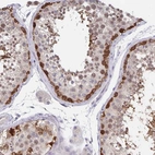 Immunohistochemical staining of human testis shows strong nuclear and cytoplasmic positivity in spermatogonia.