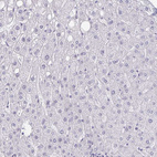 Immunohistochemical staining of human liver shows no cytoplasmic positivity in hepatocytes as expected.