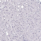 Immunohistochemical staining of human liver shows no cytoplasmic positivity in hepatocytes as expected.