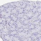 Immunohistochemical staining of human stomach shows no cytoplasmic positivity in glandular cells.