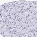 Immunohistochemical staining of human stomach shows no cytoplasmic positivity in glandular cells.